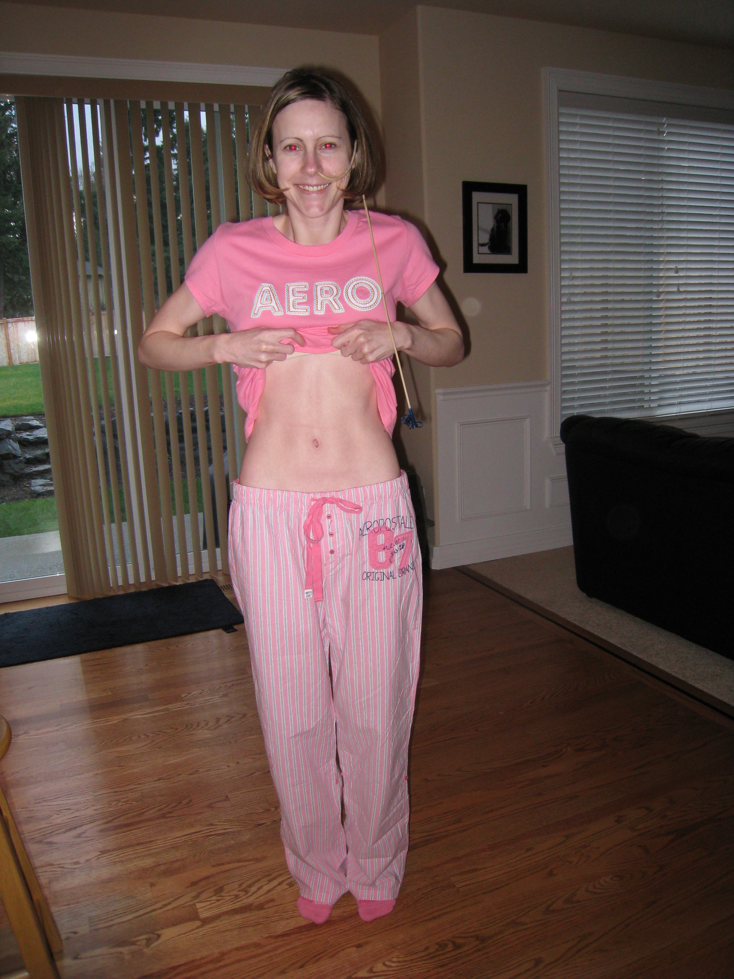 gastroparesis surgery recovery time)